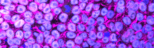 Induced pluripotent stem cells
