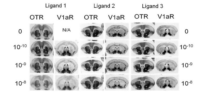 Imaging of Novel Ligand in Brain Tissue