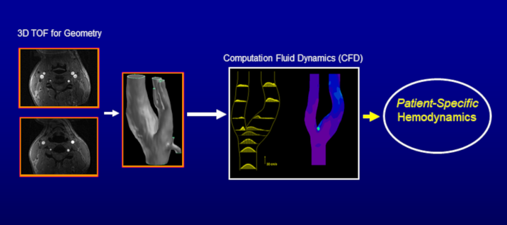 Hemodynamics of Blood Flow in Carotid Arteries Using MRI