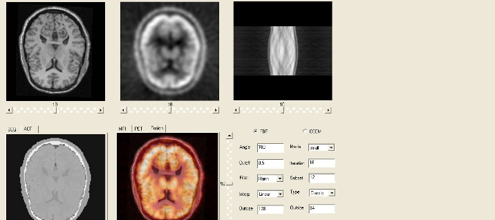 Quantitative Image Analysis of Brain Tissues