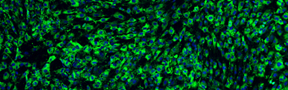 Skin-derived fibroblasts