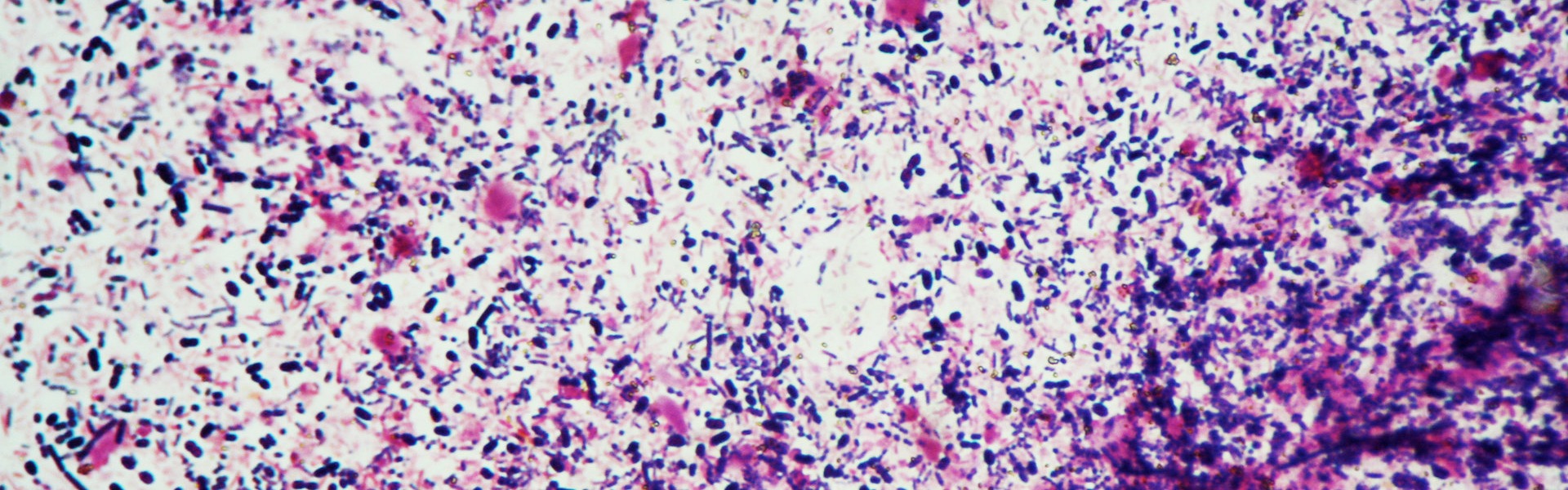 bacteria gram negative