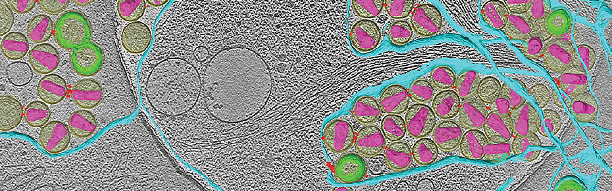 Cryo-electron tomography of HIV-infected cells