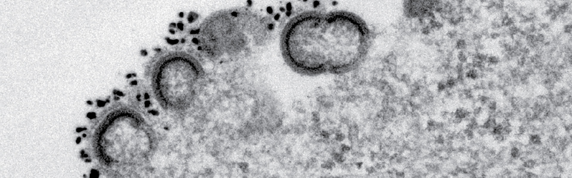 electron microscopy hiv