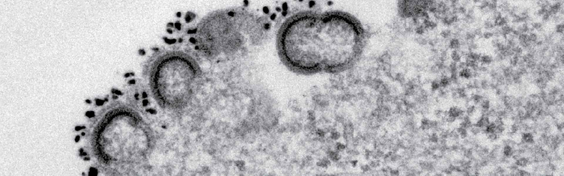 TEM immunogold HIV release