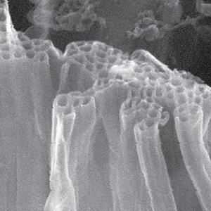 amyloid-beta-nanotubes