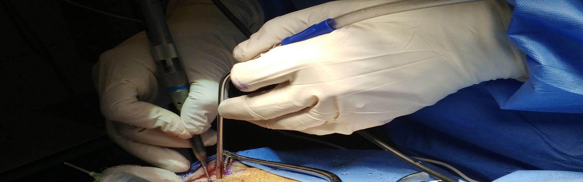 Surgeons hands suction